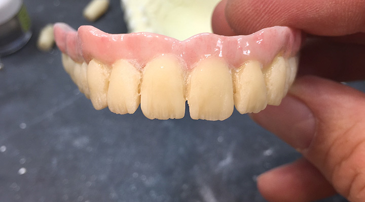 Reduzierung und Charakterisierung der Zahnform