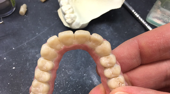 Reduzierung und Charakterisierung der Zahnform